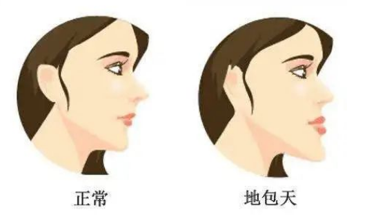 Face Shape of Earth Covering Heaven
