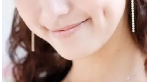 facial dimples in facial aesthetics